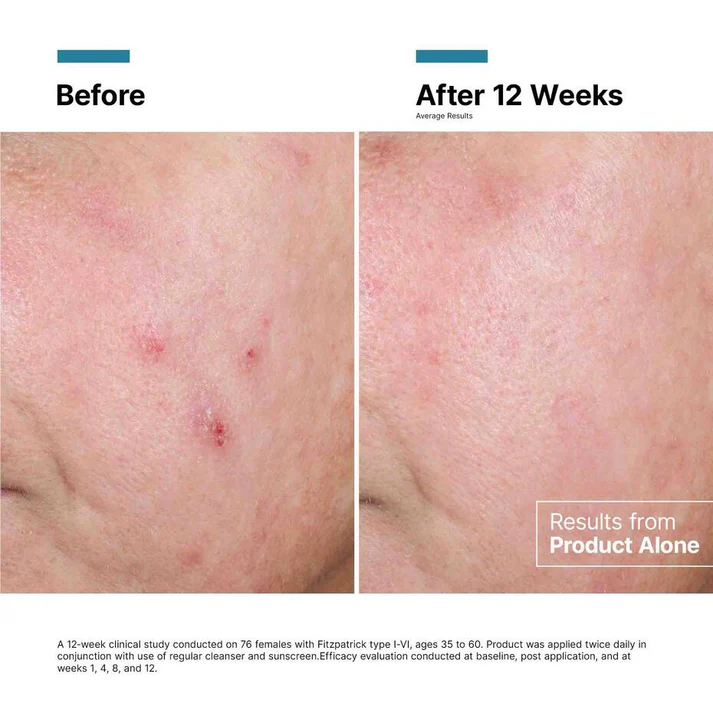 Advanced RGN-6 - View 4