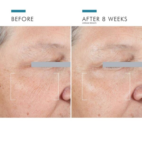 23_0919_SKC_PDP23_COR_AGE_ADV_EYE2 A.G.E. Advanced Eye for Dark Circles 15ml