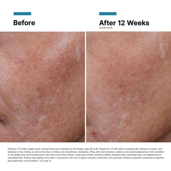 24_0104_SKC_HAI_Alt_Images_ProductProduct_Slide_13_Before+_After Hyaluronic Acid Intensifier Multi-Glycan 30ml